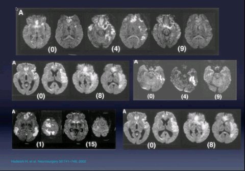 IPB Image