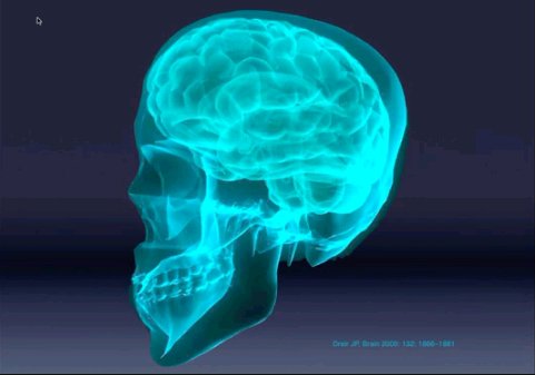 IPB Image