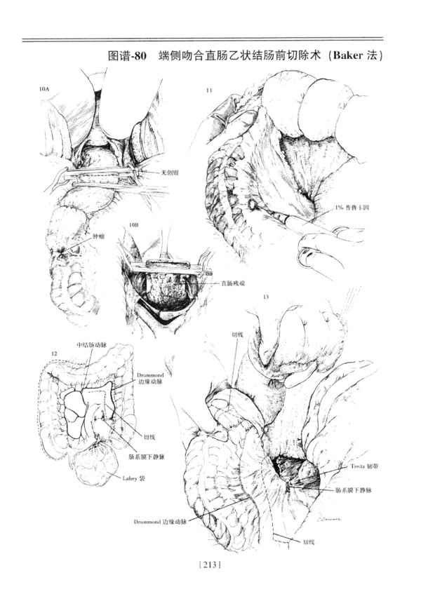 IPB Image