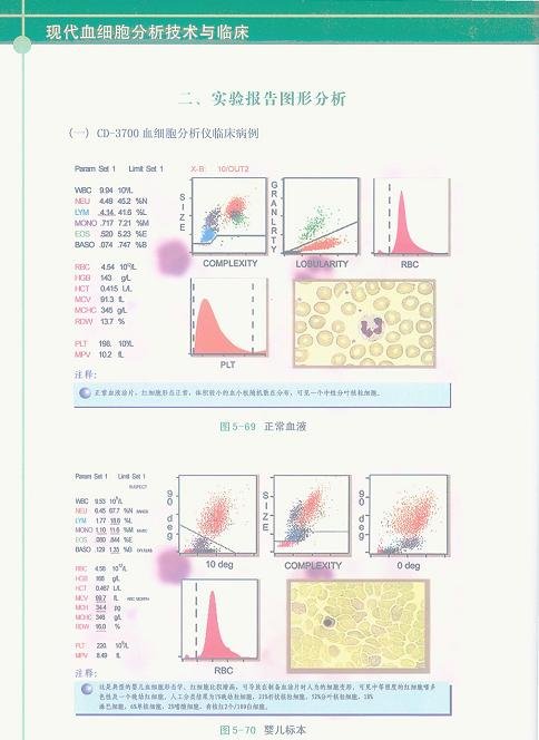 IPB Image
