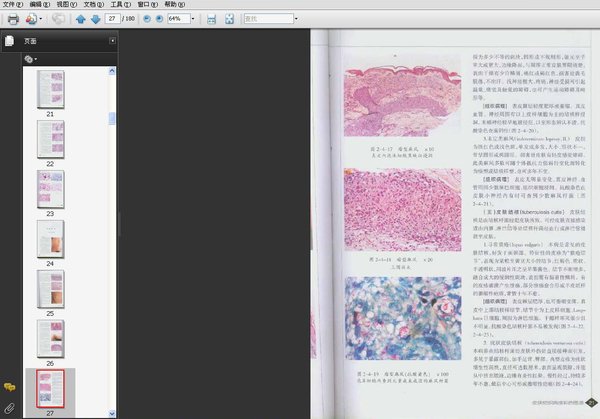 《皮肤组织病理彩色图谱》扫描版[PDF] - Very